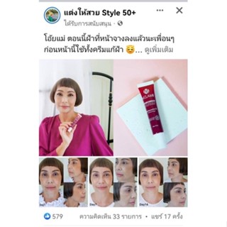 Melasmiin X 15 g (Anti-melasma: ฝ้าดูจางลงใน 1 สัปดาห์)