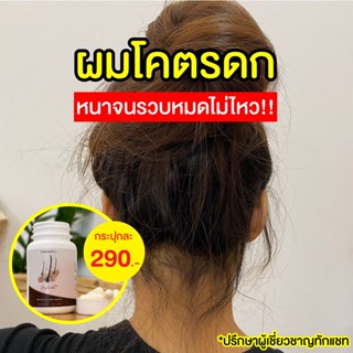 ⚡️ส่งฟรี 1 กระปุก 290.- ไฮลดา วิตามินผมดกHylada🔥 ลดการขาดร่วง ชะลอผมหงอก หนา แข็งแรง ของแท้จากบริษัท🔥