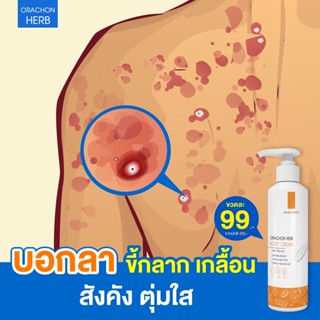 💥ส่งฟรี+พร้องส่ง &gt; Orachon  ครีมอรชร เฮิร์บ รักษาสิวหลัง สะเก็ดเงิน ผิวหนังอักเสบ ผดผื่นคัน สังคัง กลากเกลื้อน หายขาด