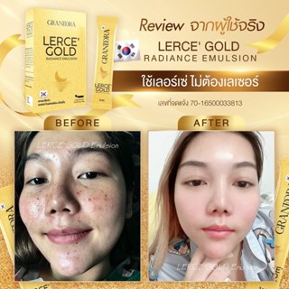 🚚 ส่งฟรี‼️ลดฝ้า กระ จุดด่างดำ ริ้วรอยก่อนวัย LerceGold มาร์ทองคำ