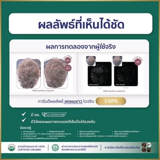 [โปรใหม่ ก.ค.] [ของแท้จากบริษัท] My Organic Hair M1 Hair Serum แฮเซรั่ม แก้ผมหงอก แก้ผมร่วง ผมบาง เซรั่มผม มายออร์
