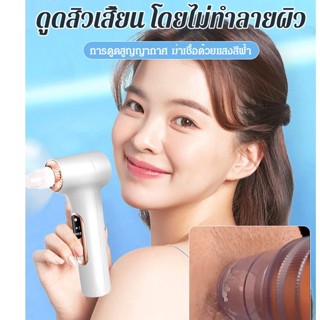 เครื่องดูดสิวเสี้ยน บำบัดด้วยแสงสีฟ้า เครื่องดูดสิว ที่ดูดสิวเสี้ยน