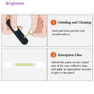 Brightstar ใหม่ แผ่นสติกเกอร์ ยืดหยุ่น สําหรับรักษาเล็บคุด เล็บเท้า