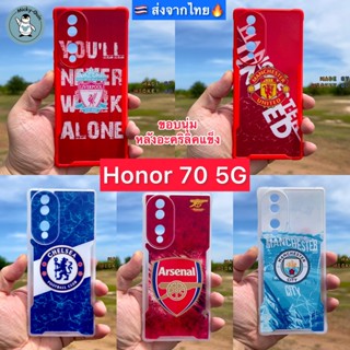 🔥เคส Honor 70 5G 🔥ขอบนุ่ม หลังอะคริลิคแข็ง กันกล้อง กันกระแทก พร้อมส่งจากไทย🇹🇭