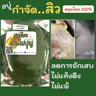 สบู่ระเพ็ด สมุนไพรออแกนิคแท้ 100% ลดสิว แก้สิวอักเส สิวฮอร์โมน สิวแพ้แมส สิวหัวช้าง ผิวแพ้ง่ายใช้ได้ ไม่แพ้