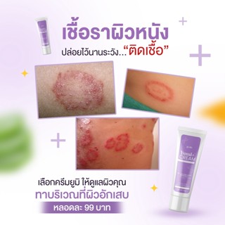 yumi cream ครีมทา กลากเกลื้อน ครีมรักษาโรคสะเก็ดเงิน ผื่นคัน โรคผิวหนัง หายขาด เห็นผลจริง