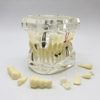 Refractable dental model, transparent color, for dentists.