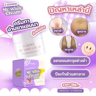 🦵🏻 Me White Cream ครีมทาง่ามขาแอนนา ครีมแม่แอนนา 30 g. (พร้อมส่ง/ของแท้ลอตใหม่💜) ครีมทาง่ามขาแอนนา Me White Cream แก้ปัญ