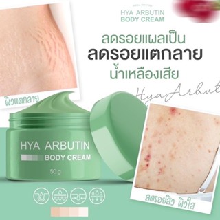 ** ลดรอยแตกลาย** ไฮยาอาบูติน บอดี้ ครีม HYA ARBUTIN BODY CREAM🏆