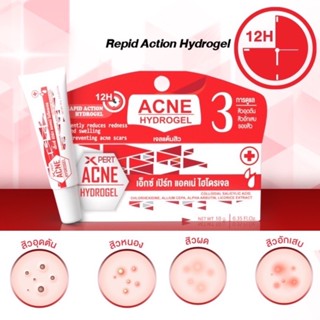 X Pert Acne Hydrogelเอ็กซ์ เปิร์ท แอคเน่ ไฮโดรเจล10gสิวอักเสบสิวผดสิวหัวหนอง