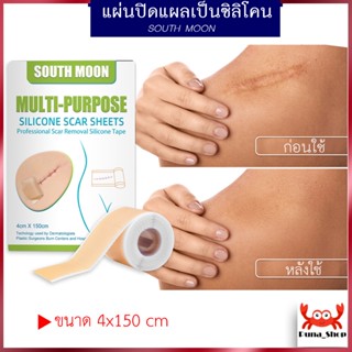 South Moon ซิลิโคนปิดแผล แผลผ่าตัด แผลหลังคลอด ซิลิโคนกำจัดรอยแผลเป็น ซิลิโคนปิดแผล