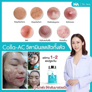 ✅ส่งฟรี🍎ยารักษาสิว สูตรแพทย์ Colla Ac By Dr Awie อาหารเสริมหมอผึ้ง วิตามินลดสิว สิวอักเสบ สิวผด สิวฮอร์โมน สิว สิวอุดตัน