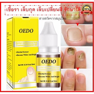 OEDO FDA รักษาเชื้อราเล็บ ยาทาเชื้อราเล็บ เชื้อราที่เล็บ รักษาเล็บ เชื้อราที่เล็บ รักษาเล็บขบ ฆ่าเชื้อราที่เล็บ10ml