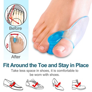 1 คู่ ซิลิโคนเจล ตาปลา แยกนิ้วเท้า ขนาดใหญ่ / เท้า Hallux Valgus แก้ไข นวด เล็บเท้า เครื่องมือ / ตัวปรับตาปลา เท้า ซิลิโคน เครื่องมือดูแล