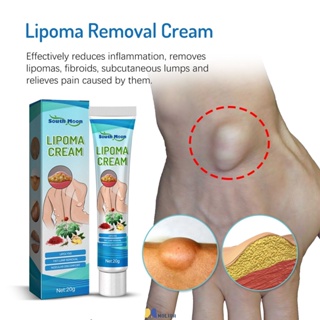 South Moon 20G Lipoma Ointment Treatment Cream Natural Plant Fat Granule Care Cream MOLISA