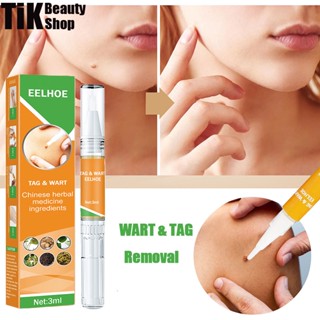 Eelhoe Wart &amp; Skin Tag Remover non irritating Anti Verruca Remedy น้ํายารักษาปากกาสมุนไพรสารสกัดจากเท้าข้าวโพดพลาสเตอร์กําจัดไฝหูดเจลทรีตเมนต์ (3 มล.)