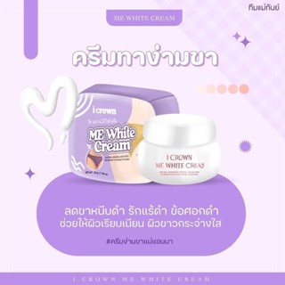 ครีมแอนนา ไอเคราน์มีไวท์ครีม CROWN ME CREAM ครีมทาง่ามขา 30 ml.