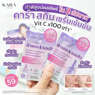 รบกวนอย่ากดซื้อ! สินค้าแถมเท่านั้น KARA SKIN แบบซอง เซรั่มหน้าใส จบรอยสิวฝ้ากระ ปรับผิวแลดูขาวกระจ่างใส สำหรับผิวแพ้
