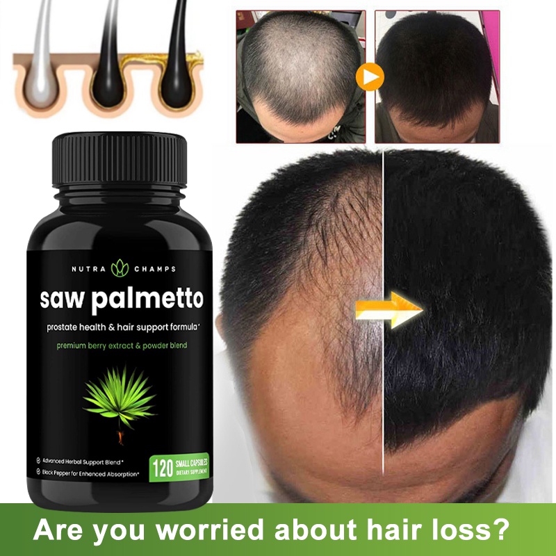อาหารเสริม Saw Palmetto Complex 600 มก. รองรับความถี่ปัสสาวะที่ดีต่อสุขภาพ, ตัวบล็อก DHT และการป้องกันผมร่วง<p>“><center><h4></h4><p><p><font color=