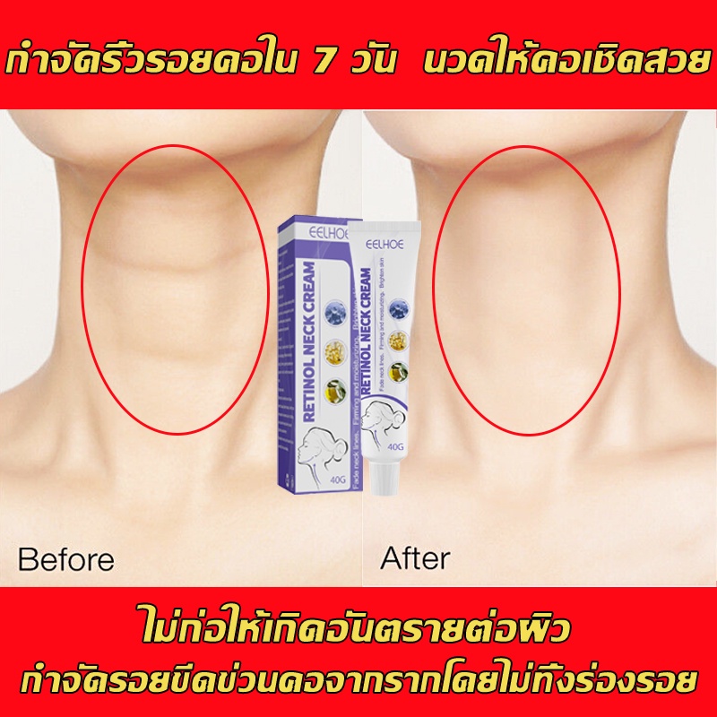 Body Cream, Lotion & Butter 96 บาท แปลงร่างเซ็กซี่ คืนคอหงส์ ครีมบำรุงผิวคอ 40g ไวท์เทนนิ่งและกระชับ ริ้วรอยลำคอหายไปอย่างรวดเร ครีมบำรุงคอ ครีมทาคอ Beauty