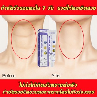 🔥แปลงร่างเซ็กซี่ คืนคอหงส์🔥ครีมบำรุงผิวคอ 40g ไวท์เทนนิ่งและกระชับ ริ้วรอยลำคอหายไปอย่างรวดเร ครีมบำรุงคอ ครีมทาคอ