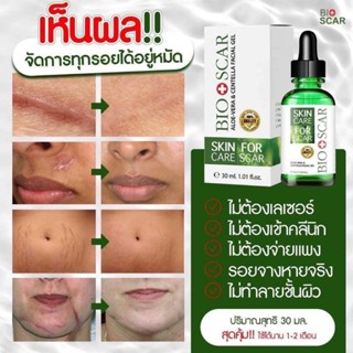 Bioscar gel ตัวช่วยเรื่องผิว ปัญหาผิว เซรั่มซึมไว ไม่เหนียวเหนอะหนะ