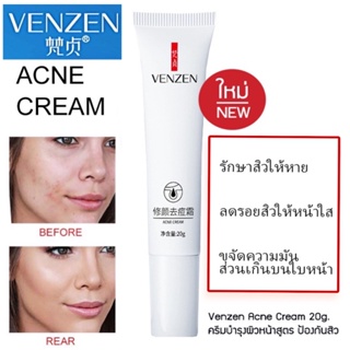 พร้อมส่งในไทย🌈Venzen Acne cream ครีมรักษาสิว รอยสิว และช่วยซ่อมแซมผิวหน้าให้กระจ่างใส 20g.🎁ฟรีของแถมเก็บเงินปลายทาง💕