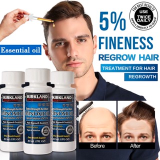 Kirkland Minoxidil 5% Topical Solution Extra Strength Mens Hair Regrowth Treatment รวม Dropper (สำหรับ 6 เดือน) 60ML