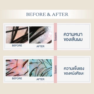 [เซ็ท สูตรลดผมร่วง] KRAAM SET Hair&Scalp Revitalizing Shampoo + Hair&Scalp Revitalizing Conditioner