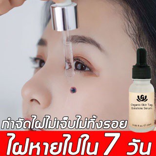 QIANYUGUAN กำจัดไฝ 20ml ไฝไม่ทิ้งร่องรอย ลดไฝลด ไฝดำกำจัดไฝ จี้ขี้แมลงวัน การกำจัดไฝ（เซรั่มกําจัดไฝ ครีมทาไฝ）