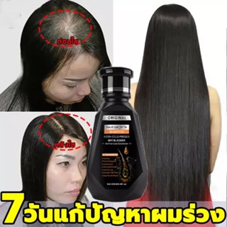 ยาสระผม แชมพูแก้ผมร่วง แชมพูขิง ยาสระผมแก้ร่วง 250ml ขิงช่ สูตรเข้มข้นพิเศษ ซ่อมแซมผมเสีย เร่งผมเกิดใหม่ ยาสระผมเร่งยาว