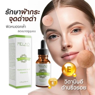 Melao เซรั่มสารสกัดเข้มข้น Hyaluronic Acid 2.5% ลดเลือนริ้วรอย ฝ้า กระ จุดด่างดำ และเพิ่มความชุ่มชื้นให้ผิวหน้า