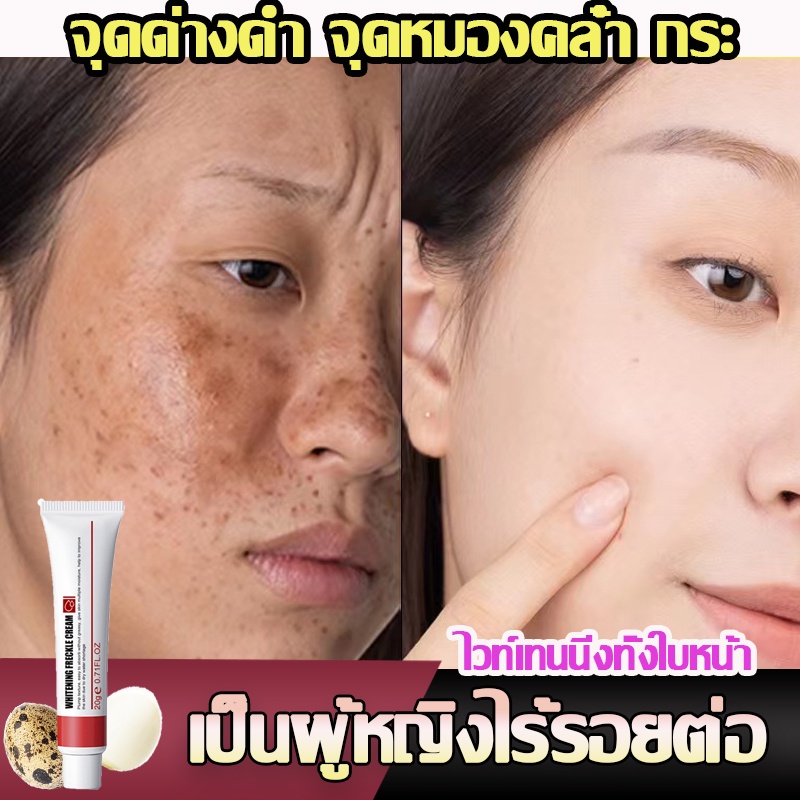 ครีมรักษาฝ้า ลดเม็ดสีเมลานิน 20g
