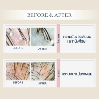 [เซ็ท สูตรลดผมร่วง] KRAAM SET Hair&Scalp Revitalizing Shampoo + Hair&Scalp Revitalizing Conditioner