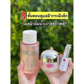 Purewhite เซตฝ้า 3 ขั้นตอน เซรั่ม+ครีม+น้ำตบผิวใสลดสิวฝ้า