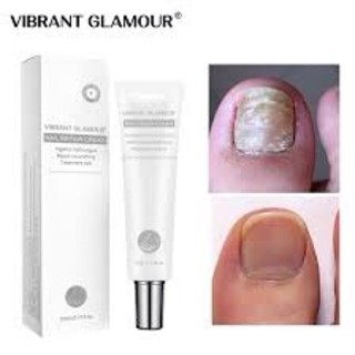 ❤️Love Sale❤️ VIBRANT GLAMOUR Nail Repair รักษาเล็บ ครีมรักษาเล็บ ครีมทาเล็บ รักษาเชื้อราที่เล็บ รักษาเล็บขบ