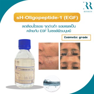 sH-Oligopeptide-1 (EGF) ลดเลือนริ้วรอย จุดด่างดำ รอยแผลเป็น คล้ายกับ EGF ในเซลล์ผิวมนุษย์ /1P010