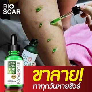 ไบโอสการ์ Bioscarไบโอสการ์ ลบแผลเป็นตุ่ม รอยสิว ผิวแพ้ง่ายใช้ได้ !!ปรับผิวขาว เรียบเนียน