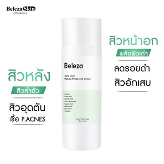 [3ชิ้นลด10%]Beleza Skin Body Acne Lotion โลชั่นลดสิวหลัง สิวหน้าอก สิวลำตัว 45 ml