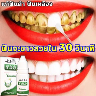 เซรั่มฟอกฟันขาว ยาสีฟันฟอกฟันขาว ดูแลช่องปาก ปากกาฟอกฟันขาว แก้กลิ่นปากเหม็น แก้ฟันเหลือง เจลฟอกฟันขาว ป้องกันหินปูน