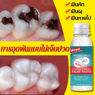 🦷ฟันปลอม ฟันปลอม ซิลิโคน ของแทั กาวติดฟันปลอม กาวติดฟันอยู่บ้านก็อุดฟันได้ การซ่อมแซมฟันผุที่ไม่เจ็บปวด ใช้ซ้ำได้