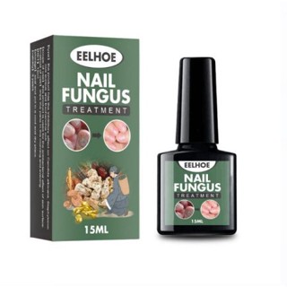 Eelhoe nail fungus น้ำยาบำรุงเล็บกำจัดเชื้อราที่เล็บได้ล้างเชื้อราเล็บได้ผลจากสมุนไพรธรรมชาติ