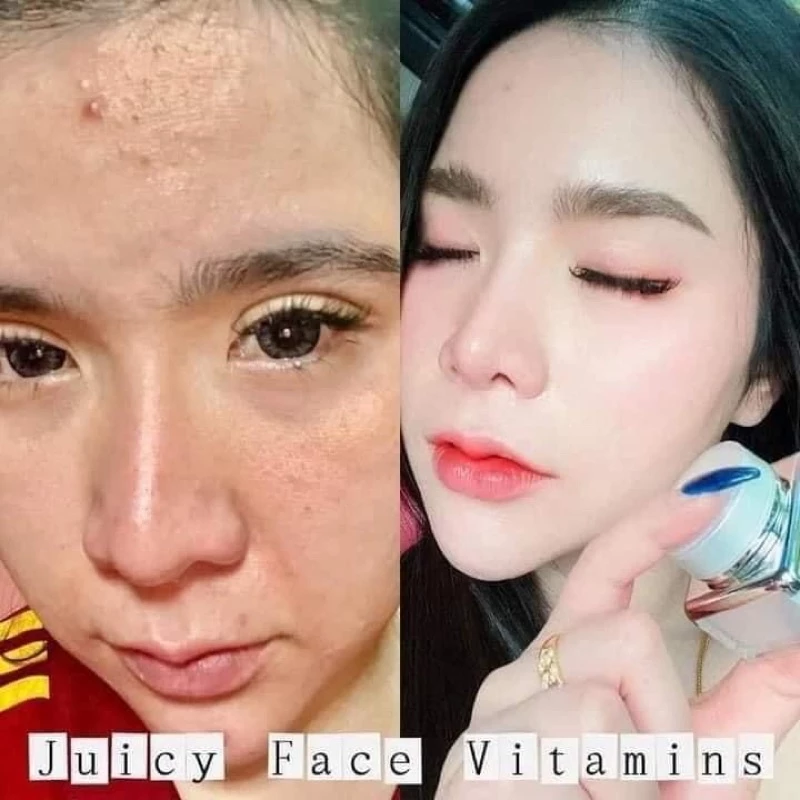 วิตตามินหน้าใสสูตรดั้งเดิม+มีของแถมของแท้ หน้าอิ่มน้ำ ฟื้นฟูผิวอ่อนแอ💕 มีปลายทางพร้อมส่ง thumbnail 5