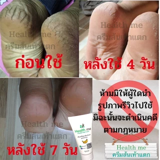 ✅ได้ผลจริง✅ครีมส้นเท้าแตก Health me ใช้จริง หายชัวร์