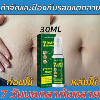 【มีผลใน7 วัน】ครีมทาท้องลาย ผิวแตกลาย30g🔥แก้ท้องลาย ลดรอยแตกลาย ขาแตกลาย สะโพกลาย ผิวลาย รอยแตกลาย ครีมลดรอยแตกลาย