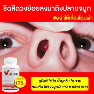 💯ส่งตรงจากบริษัท จบทุกภูมิแพ้  สารสกัดจากธรรมชาติ   ริดสีดวงจมูกแก้ให้หายขาดด้วย   ไซนัส วี-ลูติน  นำเข้าจาก3ประเทศ 🇨🇭🇺🇸