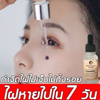 QIANYUGUAN กำจัดไฝ 20ml ไฝไม่ทิ้งร่องรอย ลดไฝลด ไฝดำกำจัดไฝ จี้ขี้แมลงวัน การกำจัดไฝ（เซรั่มกําจัดไฝ ครีมทาไฝ）