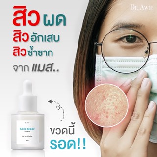 Acne Repair Serum เซรั่มสิว เซรั่มลดสิว เซรั่มรักษาสิว เซรั่มลดรอยสิวผิวแพ้ง่าย