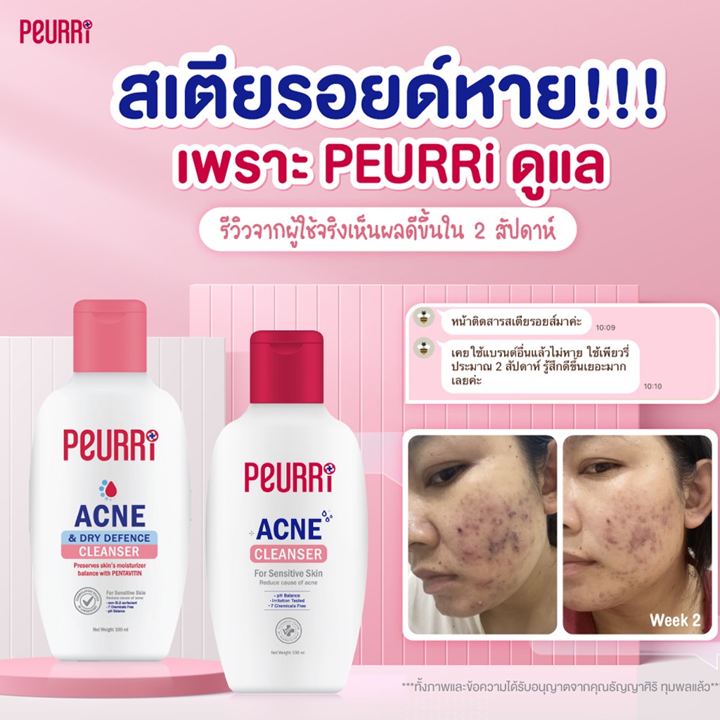 เจลล้างหน้า & เจลแต้มสิว เพียวรี แอคเน่ จบทุกปัญหาสิว PEURRi  Acne Cleanser / PEURRi Anti Acne Gel รูปที่ 8
