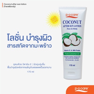 POCARE COCONUT AFTER SUN lOTION ( Face&amp;Body) โลชั่นบำรุงผิวแสบไหม้หลังออกแดด สูตรมะพร้าว #POCareThailand